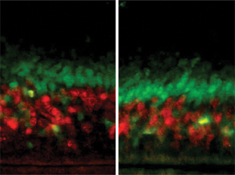  השוואה בין מוח של עכבר המייצר כמויות עודפות של החלבון LIS1 (מימין), למוח עכבר ביקורת המייצר כמויות רגילות של החלבון (משמאל). הצביעה הירוקה והאדומה מייצגת שתי שכבות שונות במוח העכבר. ניתן לראות, כי השכבה האדומה רחבה יותר בעכבר הביקורת, וכי סידור התאים בעכבר זה מאורגן יותר